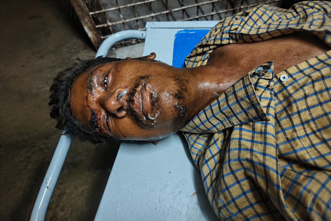 Police investigating unidentified man's body near Lingampally market.