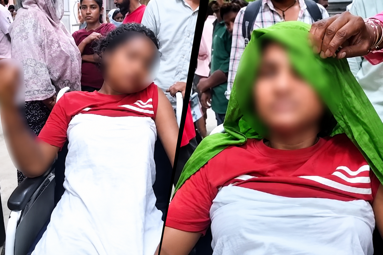 Faridabad woman receiving treatment after alleged hot water attack