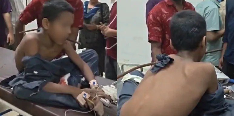 13-year-old boy undergoes emergency surgery after Surat accident.