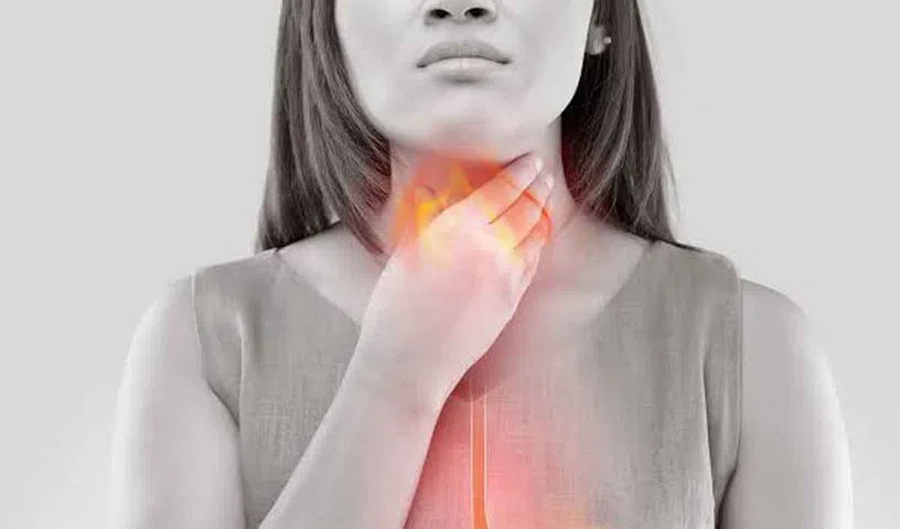 Woman experiencing heartburn while managing acid reflux symptoms