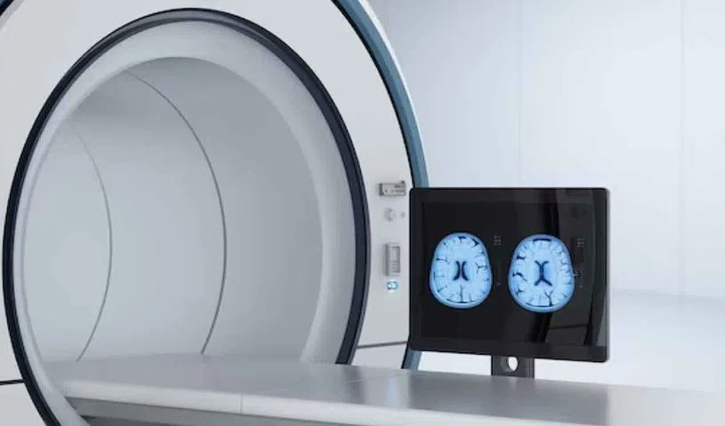 FAPI PET scan used to detect ovarian cancer spread