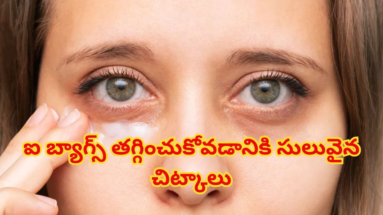 Woman showing under-eye puffiness and eye bags